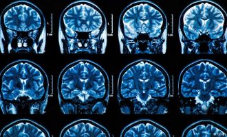 Britanski neurolozi zvone na uzbunu : Teška oštećenja mozga čak i kod lakih simptoma covida 19