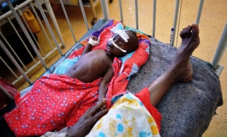 Brojka od koje se ledi krv u žilama: 258.000 umrlih od gladi u Somaliji
